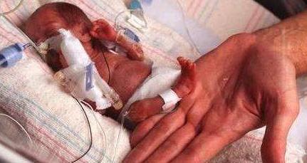 女嬰先天缺失皮膚 鮮紅肌肉暴露在外 醫(yī)生提醒孕婦要注意孕期環(huán)境 女嬰先天缺失皮膚 鮮紅肌肉暴露在外 醫(yī)生提醒孕婦要注意孕期環(huán)境