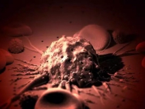 癌癥、白血病越來(lái)越多,是因?yàn)闀r(shí)代在進(jìn)步而導(dǎo)致的嗎?