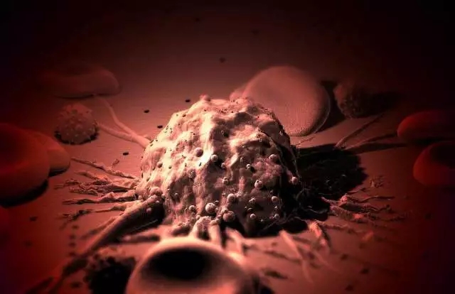 癌癥、白血病越來越多，是因?yàn)闀r代在進(jìn)步而導(dǎo)致的嗎？